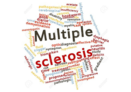 Managing Multiple Sclerosis